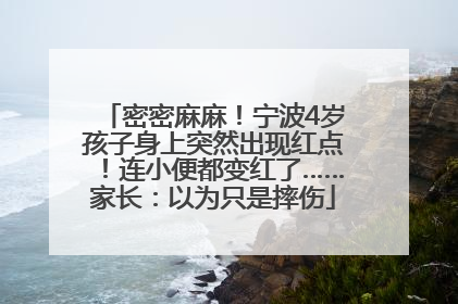 密密麻麻！宁波4岁孩子身上突然出现红点！连小便都变红了……家长：以为只是摔伤